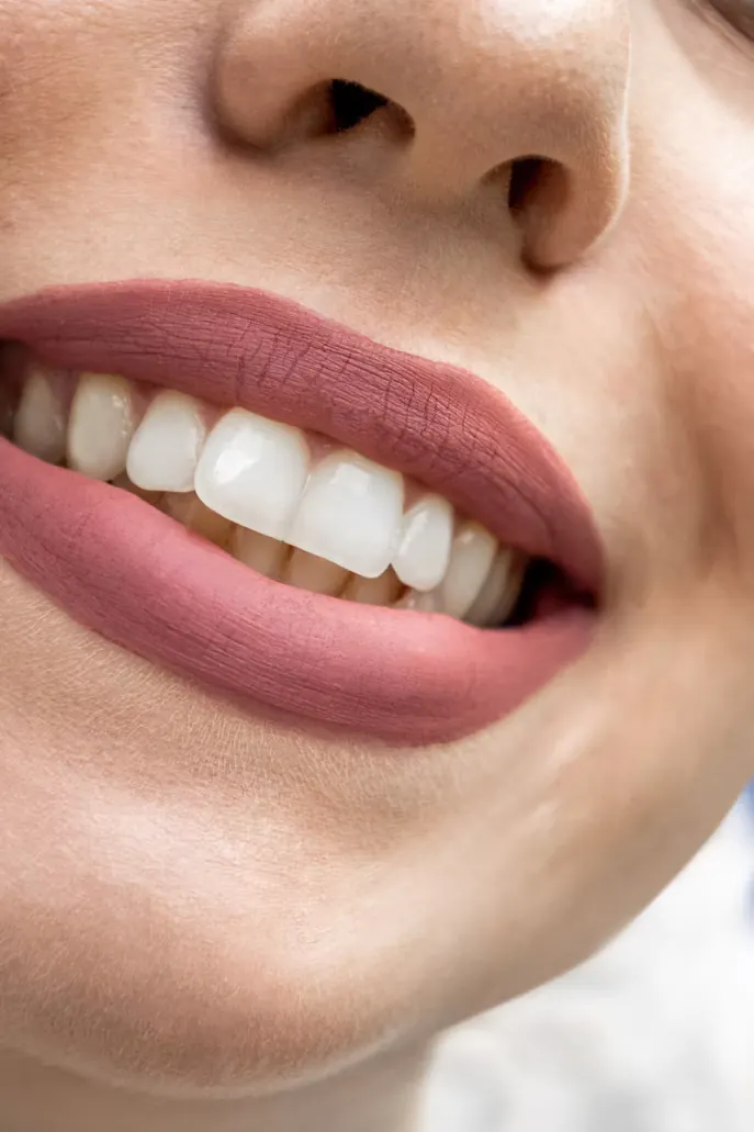 Smile Transformation Blog Post